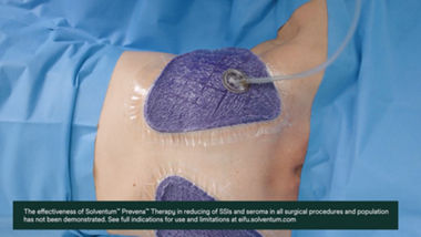 3M Prevena Therapy for plastic surgery | Solventum