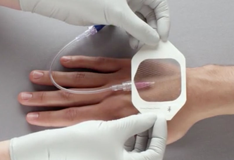 3M™ Tegaderm™ Diamond Pattern Film Dressing B+ Image 3