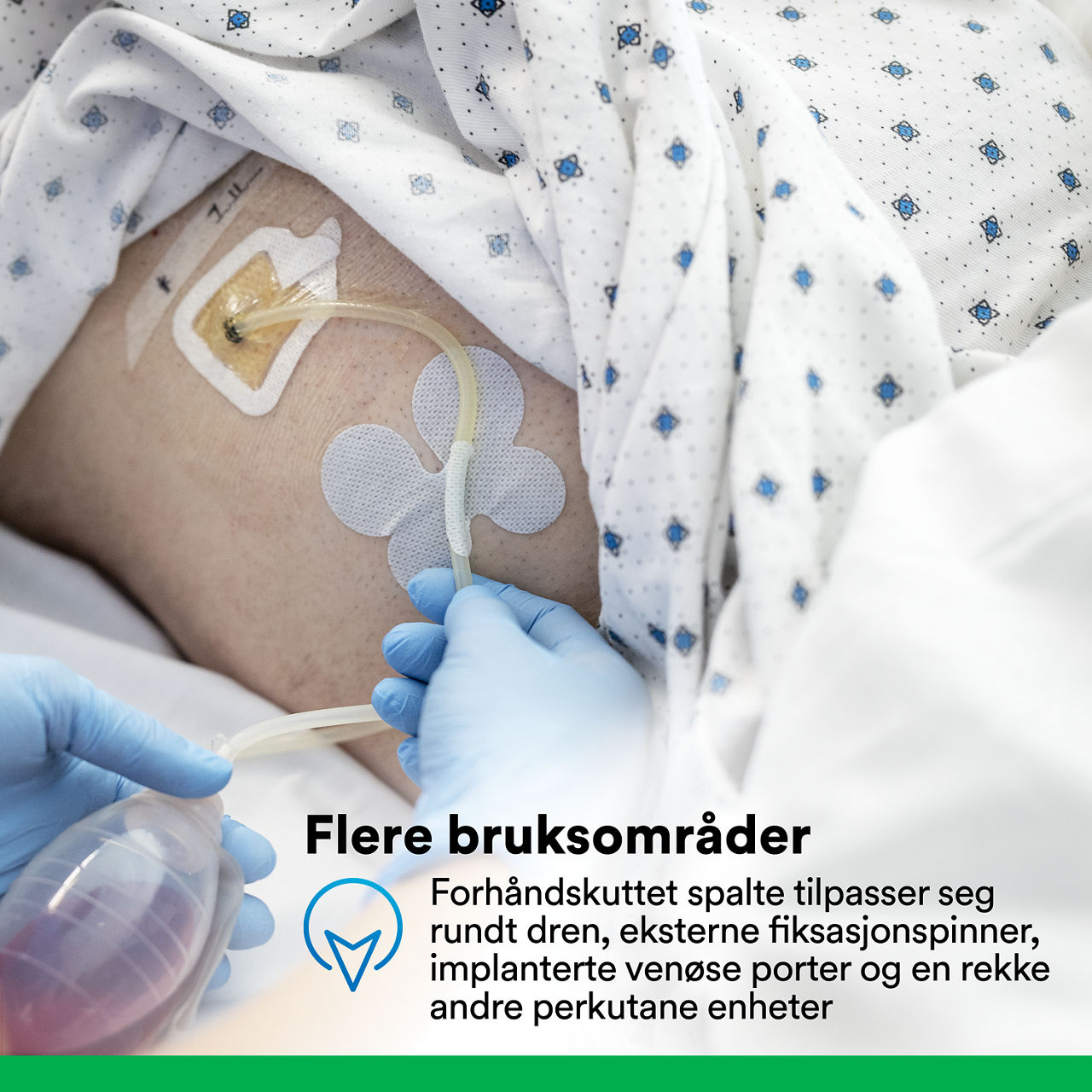 (4) Tegaderm™ CHG Gel Pad 1664/1664R: Allsidig anvendelse
