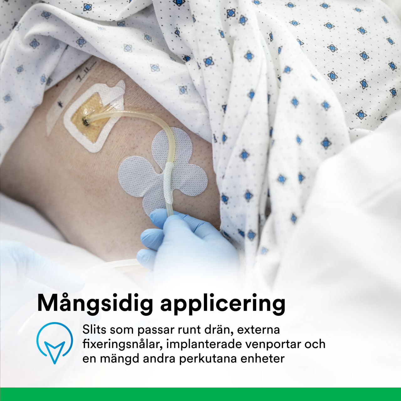 (4) Tegaderm CHG Gel Pad 1664/1664R: Mångsidig användning