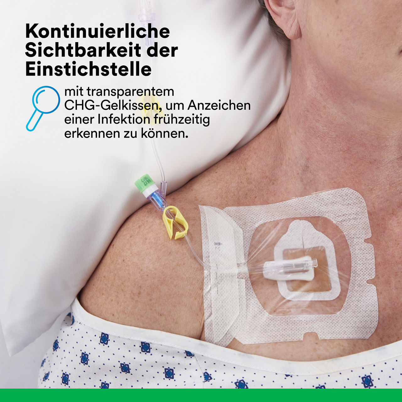 2 Tegaderm CHG Gel Pad 1664/1664R: Bestandteile des Gel Pads