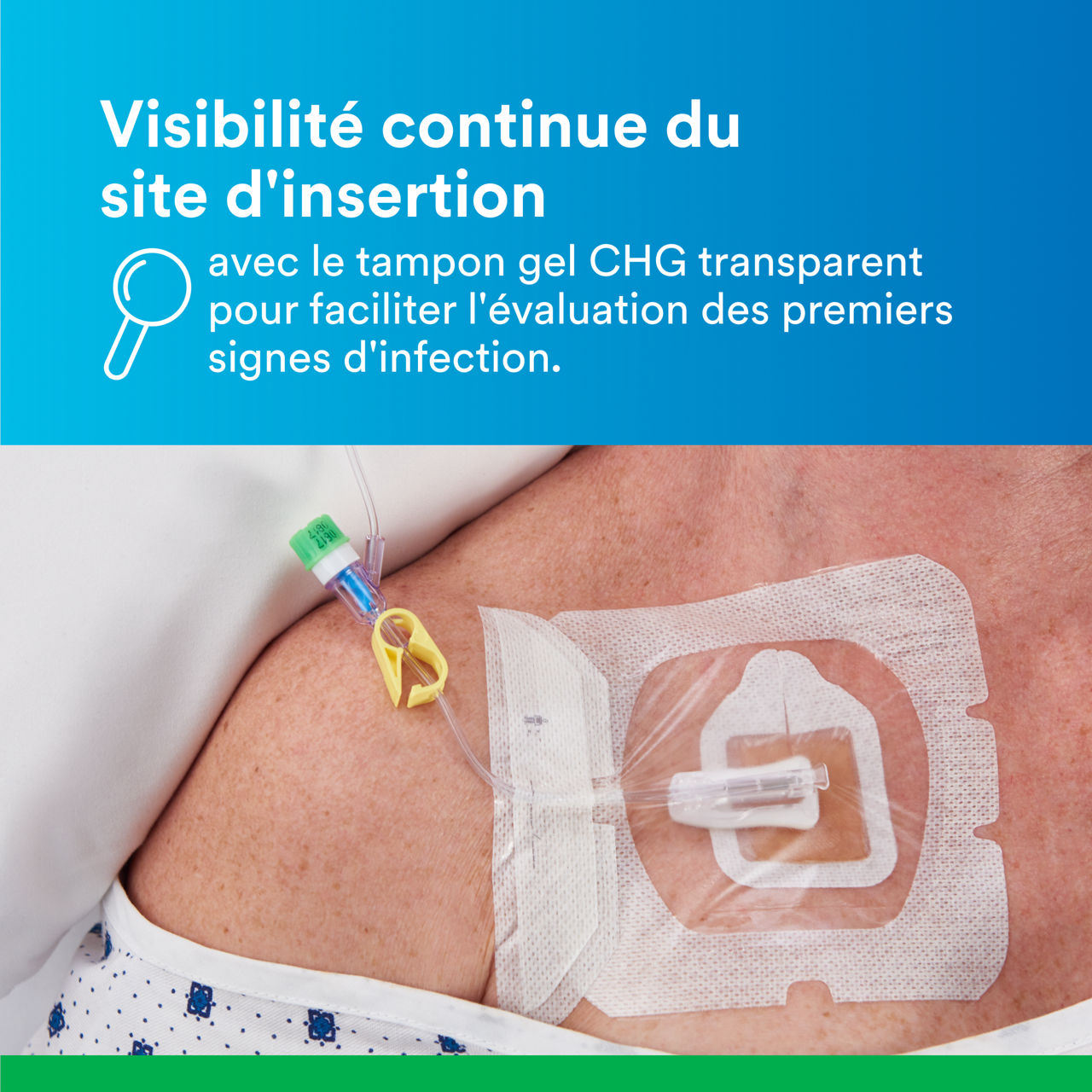 (5) Tegaderm™ CHG Gel Pad 1664/1664R : Visibilité continue du site