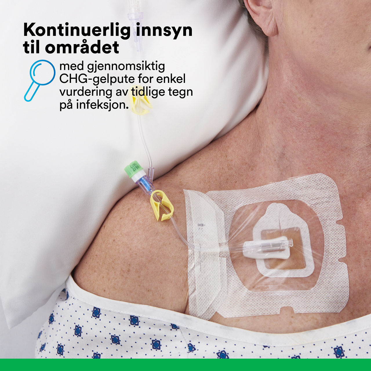 (5) Tegaderm™ CHG Gel Pad 1664/1664R: Kontinuerlig synlighet på stedet