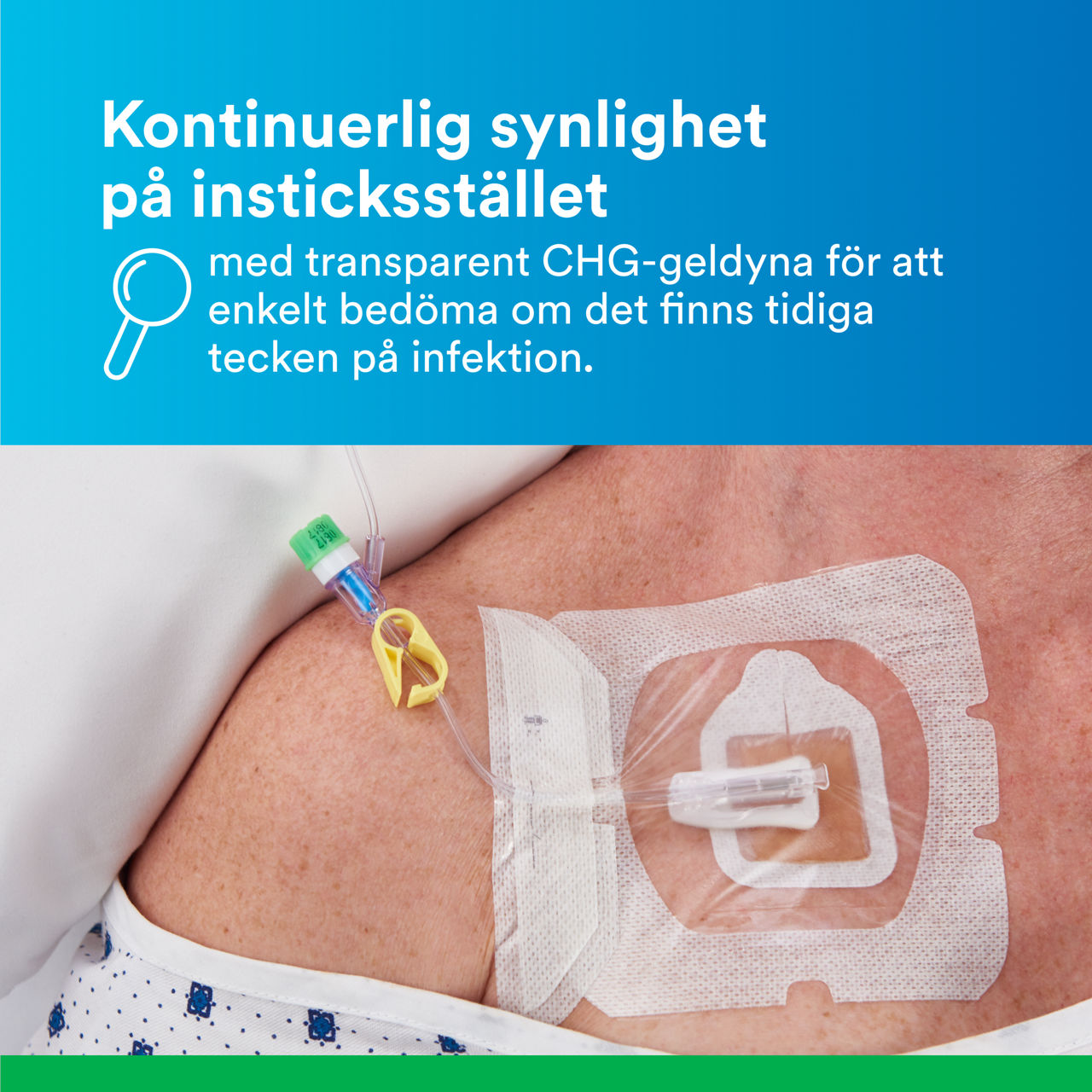 (5) Tegaderm CHG Gel Pad 1664/1664R: Kontinuerlig synlighet av området
