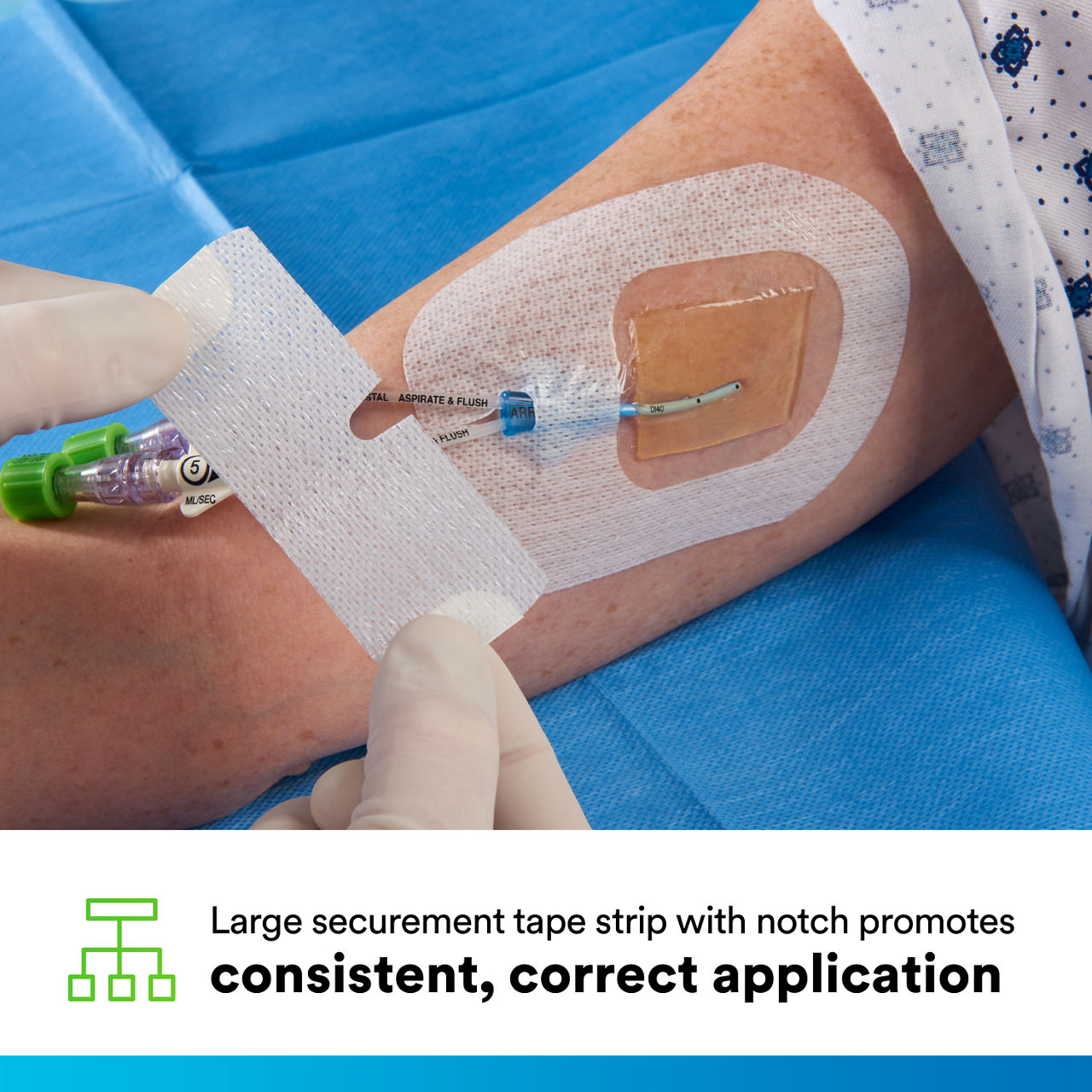 (4) Tegaderm CHG IV Securement 1657: Consistent, correct application