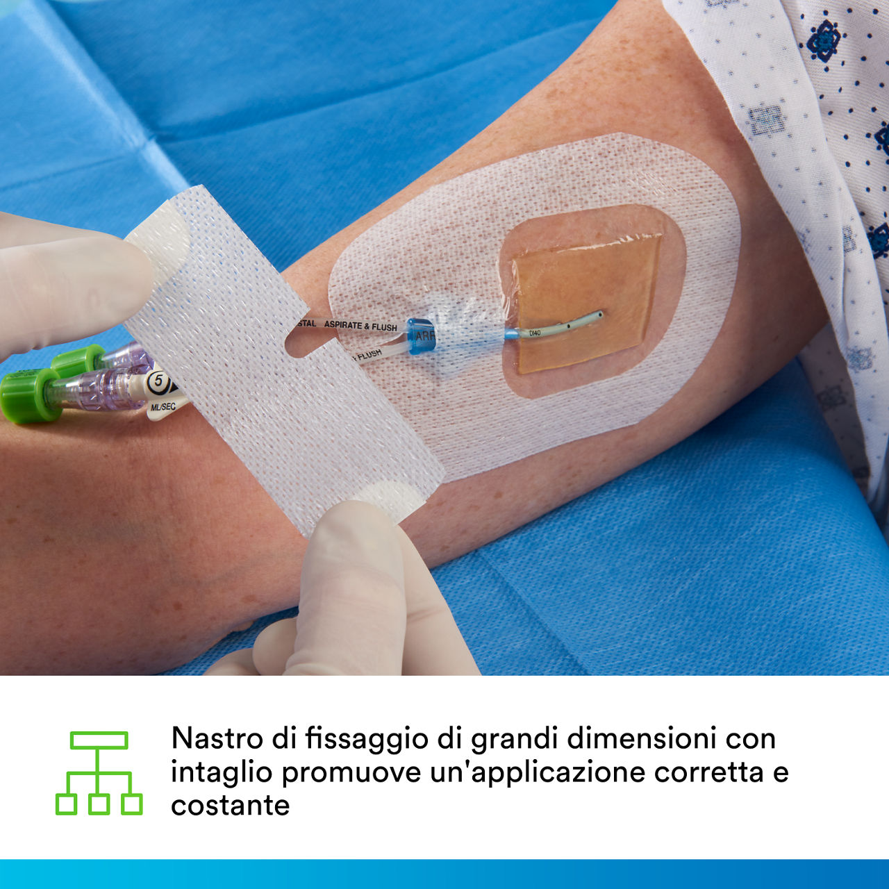(4) Tegaderm CHG IV Securement 1657: Consistent, correct application