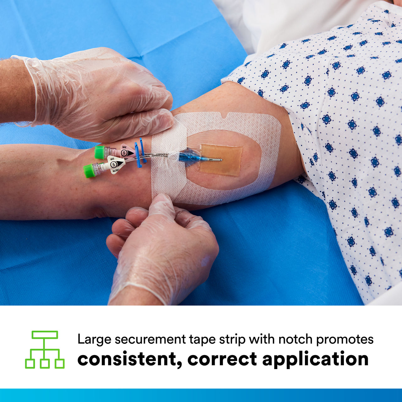 (4) Tegaderm CHG IV Securement 1658: Consistent, correct application