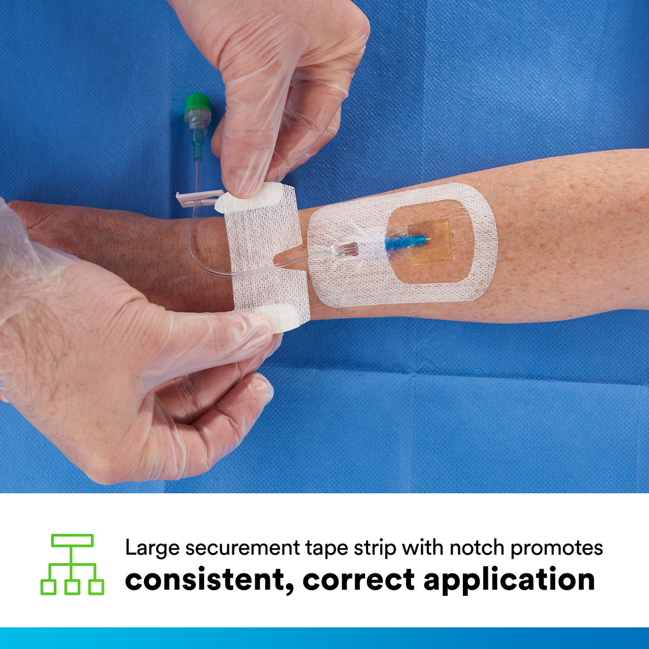 (4) Tegaderm CHG IV Securement 1660: Consistent, correct application