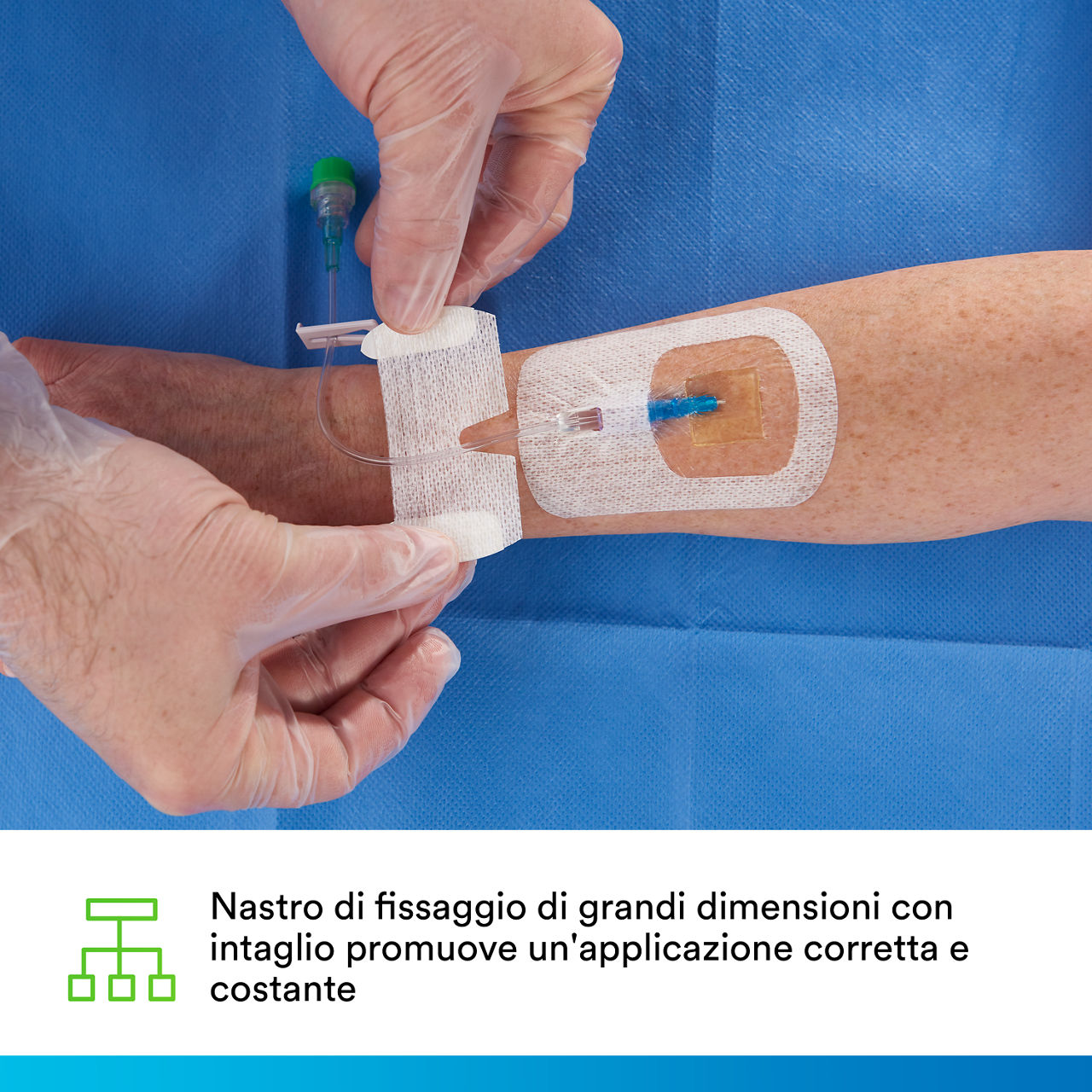 (4) Tegaderm CHG IV Securement 1660: Consistent, correct application