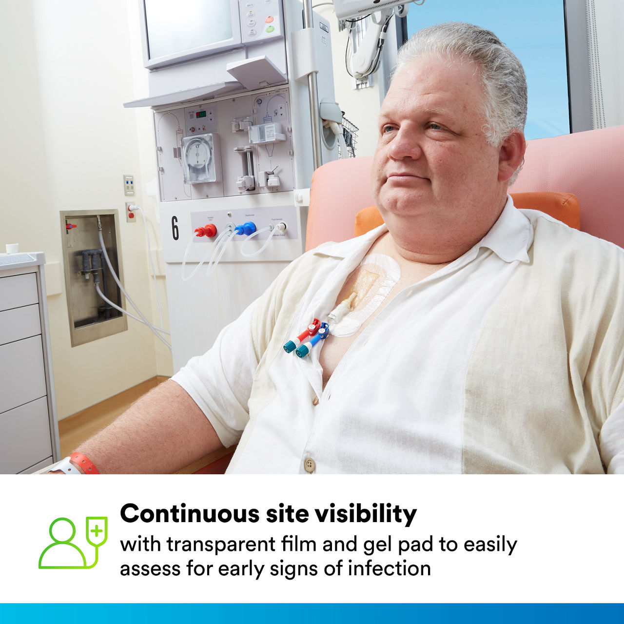 (5) Tegaderm CHG IV Securement 1659: Continuous site visibility