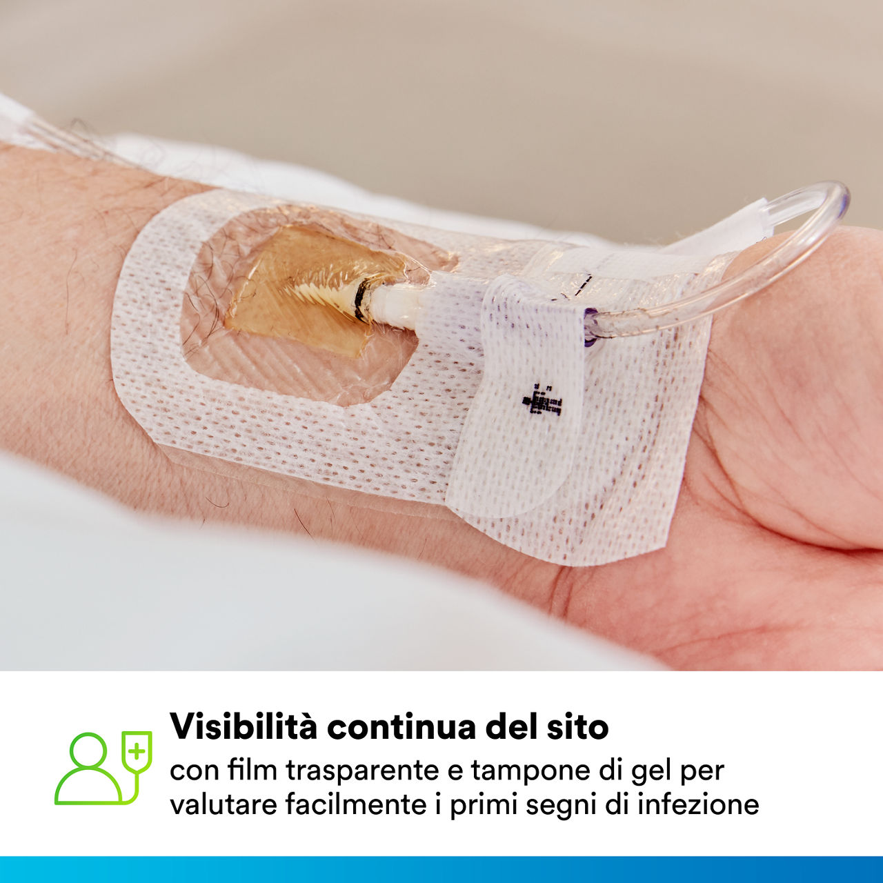 (5) Tegaderm CHG IV Securement 1660: Continuous site visibility