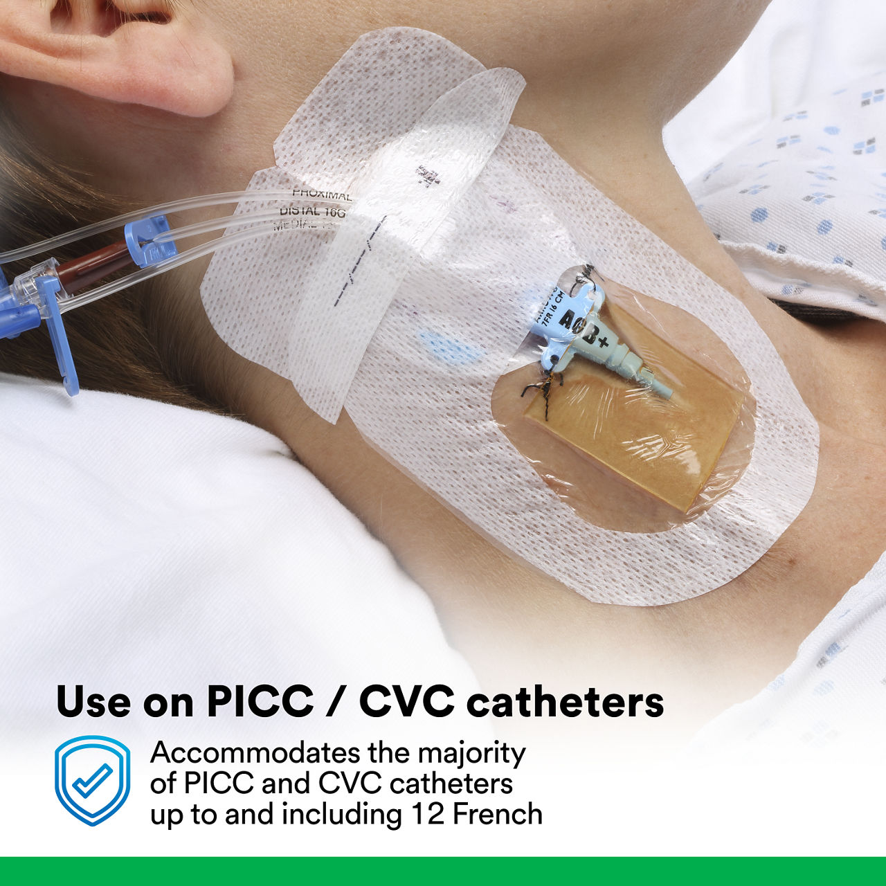 (6) PICC/CVC Device + CHG IV Dressing 1877-2100: Use on PICC/CVC catheters