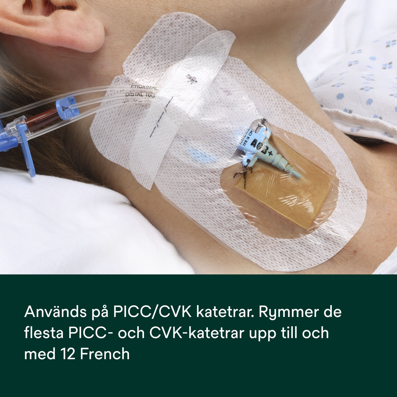 (6) PICC/CVC Device + CHG IV Dressing 1877-2100: Användning på PICC/CVC-katetrar
