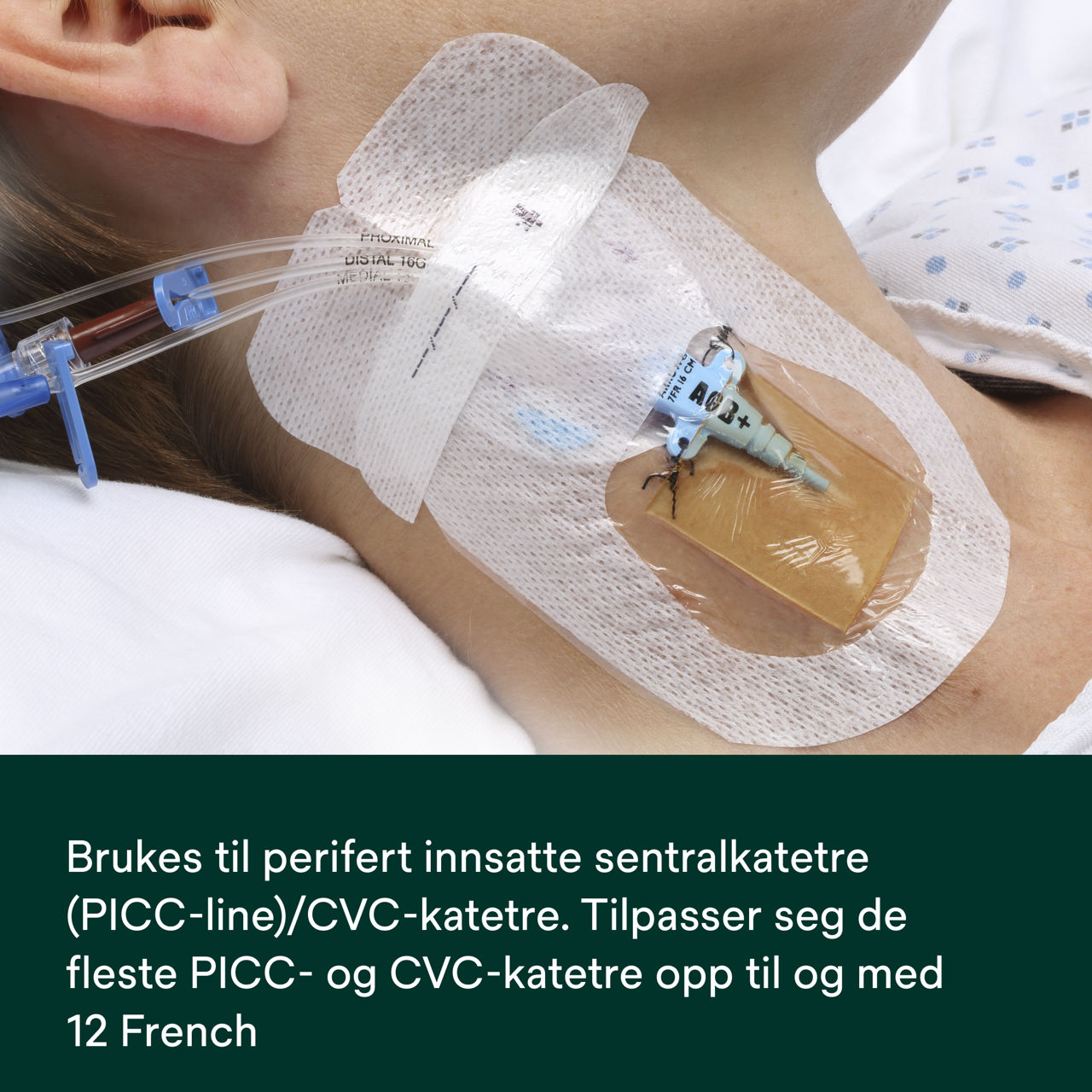 (6) PICC/CVC-enhet + CHG IV-forbinding 1879-2100: Brukes på PICC/CVC-katetre