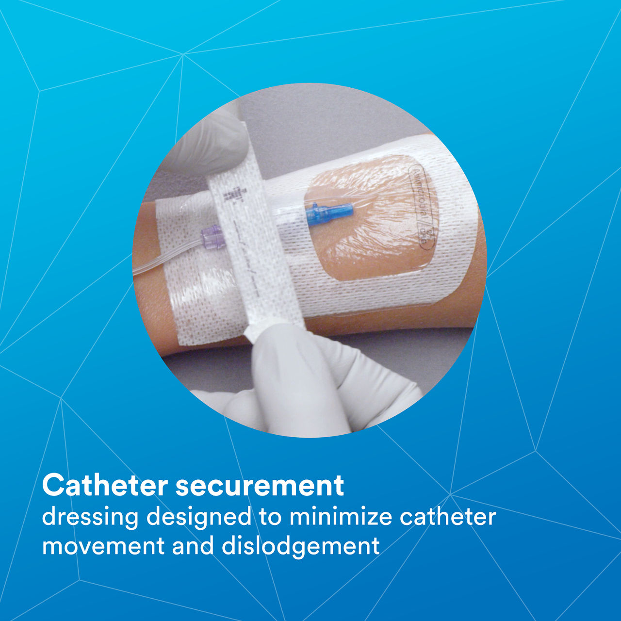 (5) Tegaderm 9132: Catheter securement