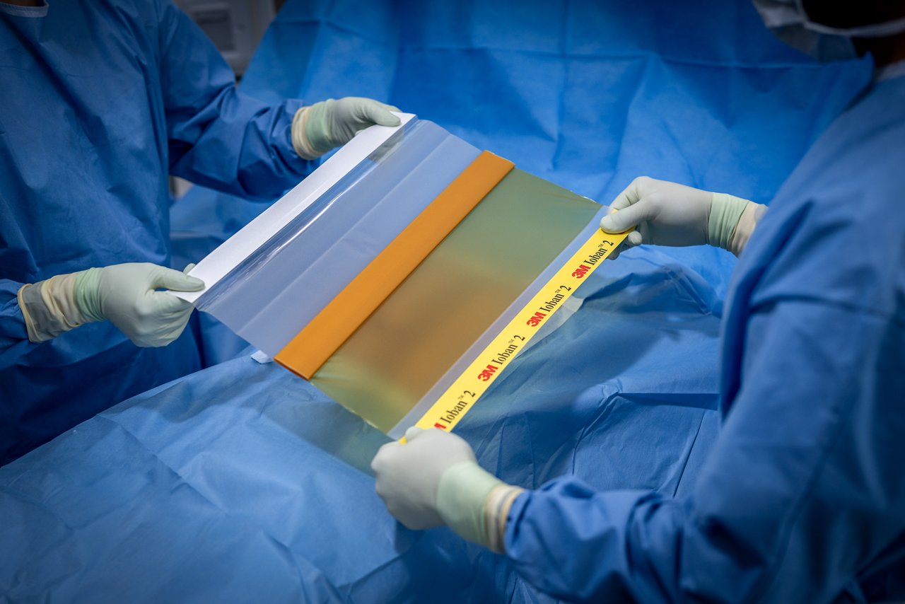 Stretching drape over patient's abdomen, 3M™ Ioban™ 2 Antimicrobial Incise Drape In Use Image - Preparing Patients for Surgery - Abdomen 2, Sept 2022, Product Application Image, rgb, tif