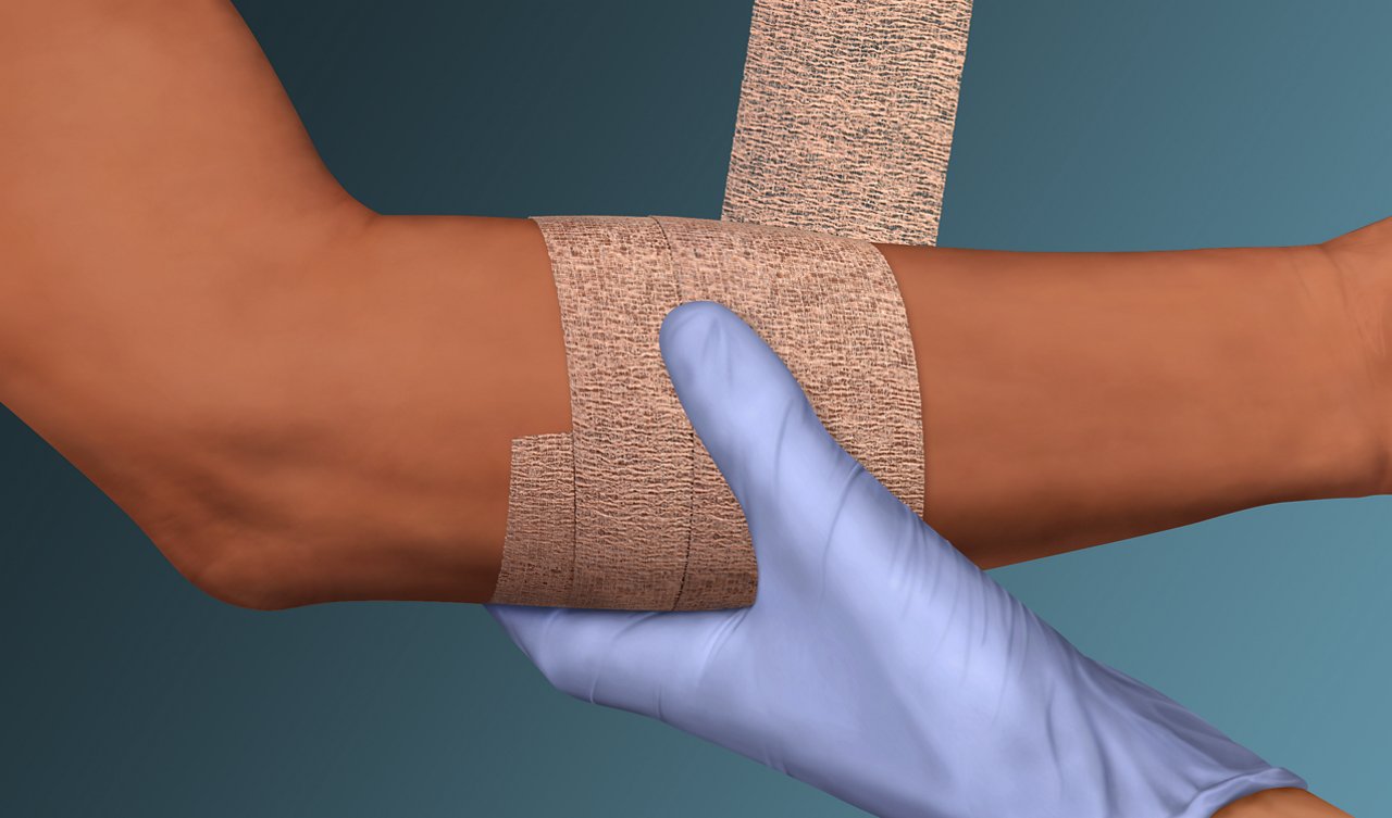 Clinician wrapping 3M™ Coban™ NL Non-Latex Self-Adherent Wrap on patient's arm