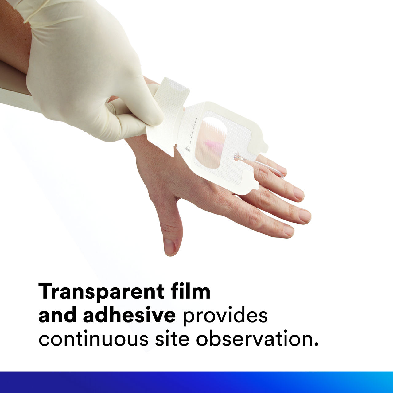 (4) Tegaderm IV Advanced Securement: Transparent film and adhesive