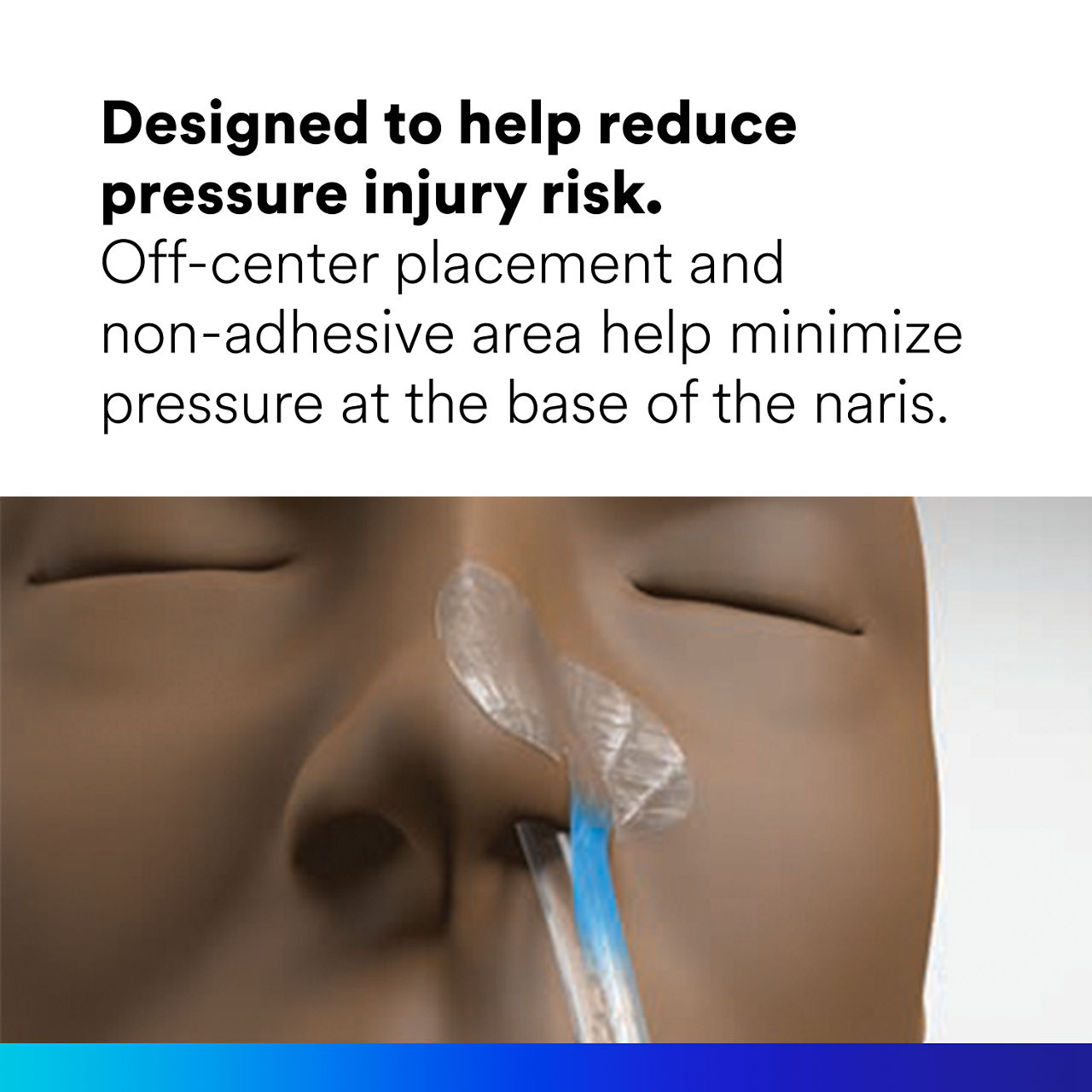 (1) Nasogastric Securement Device: Designed to help reduce pressure injury risk