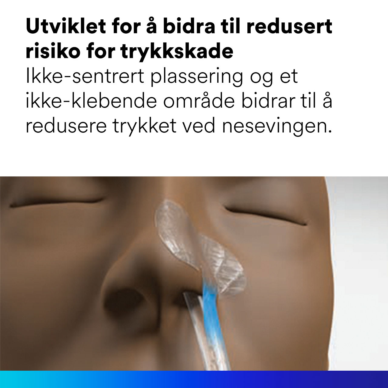 (1) Nasogastrisk festeanordning: Utformet for å redusere risikoen for trykkskader