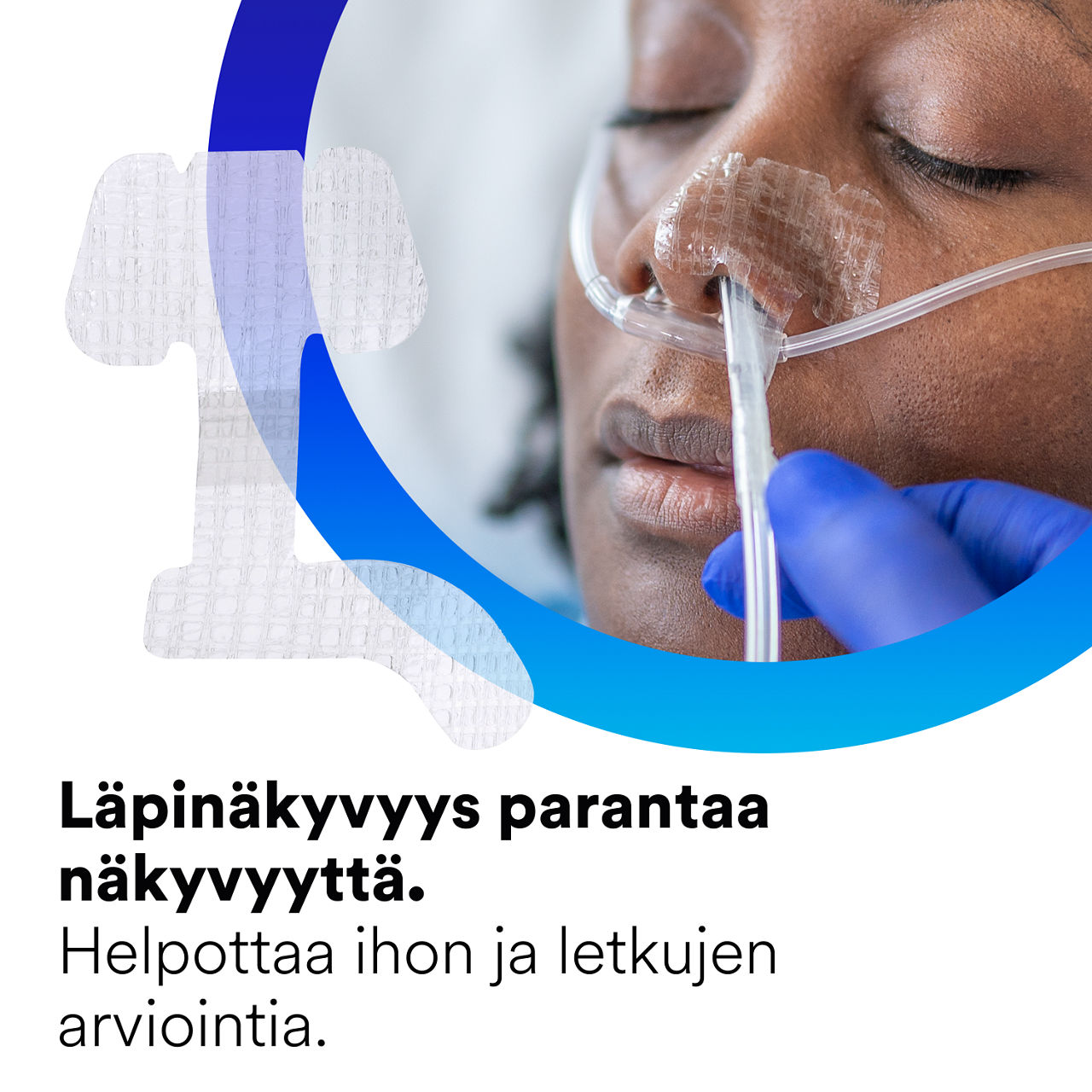 (2) Nasogastrinen kiinnityslaite: Läpinäkyvyys helpottaa ihon ja letkun arviointia