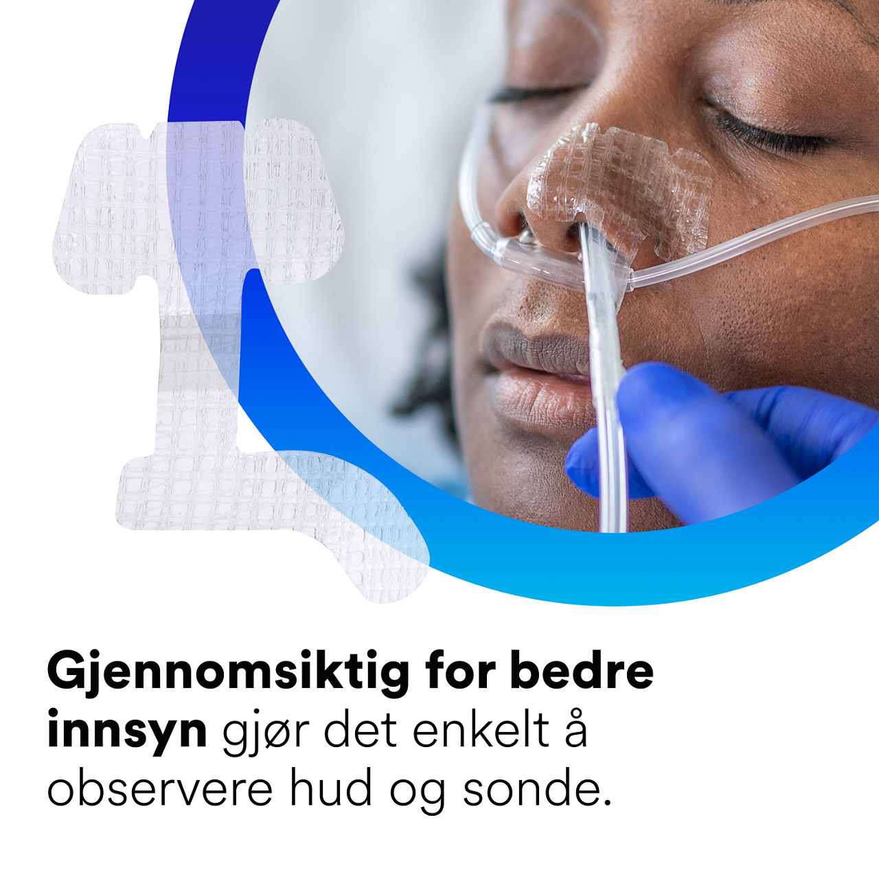 (2) Nasogastrisk festeanordning: Gjennomsiktig for å gjøre det lettere å vurdere hud og slange