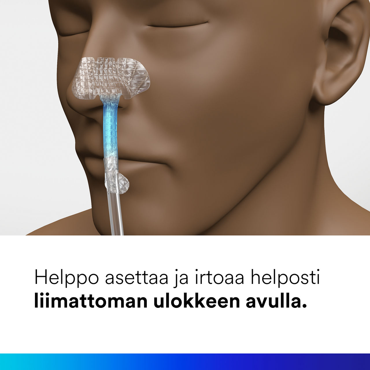 (4) Nasogastrinen kiinnityslaite: Helppo asentaa ja irrottaa siististi liimattoman kielekkeen avulla