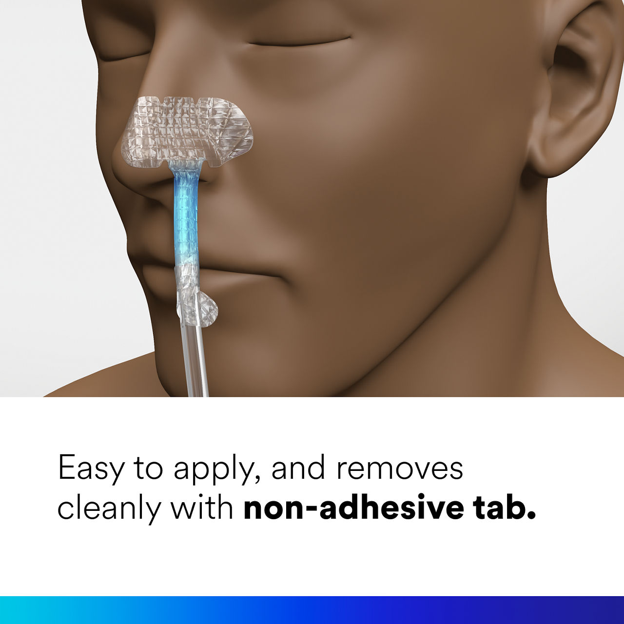 (4) Nasogastric Securement Device: Easy to apply and removes cleanly with non-adhesive tab