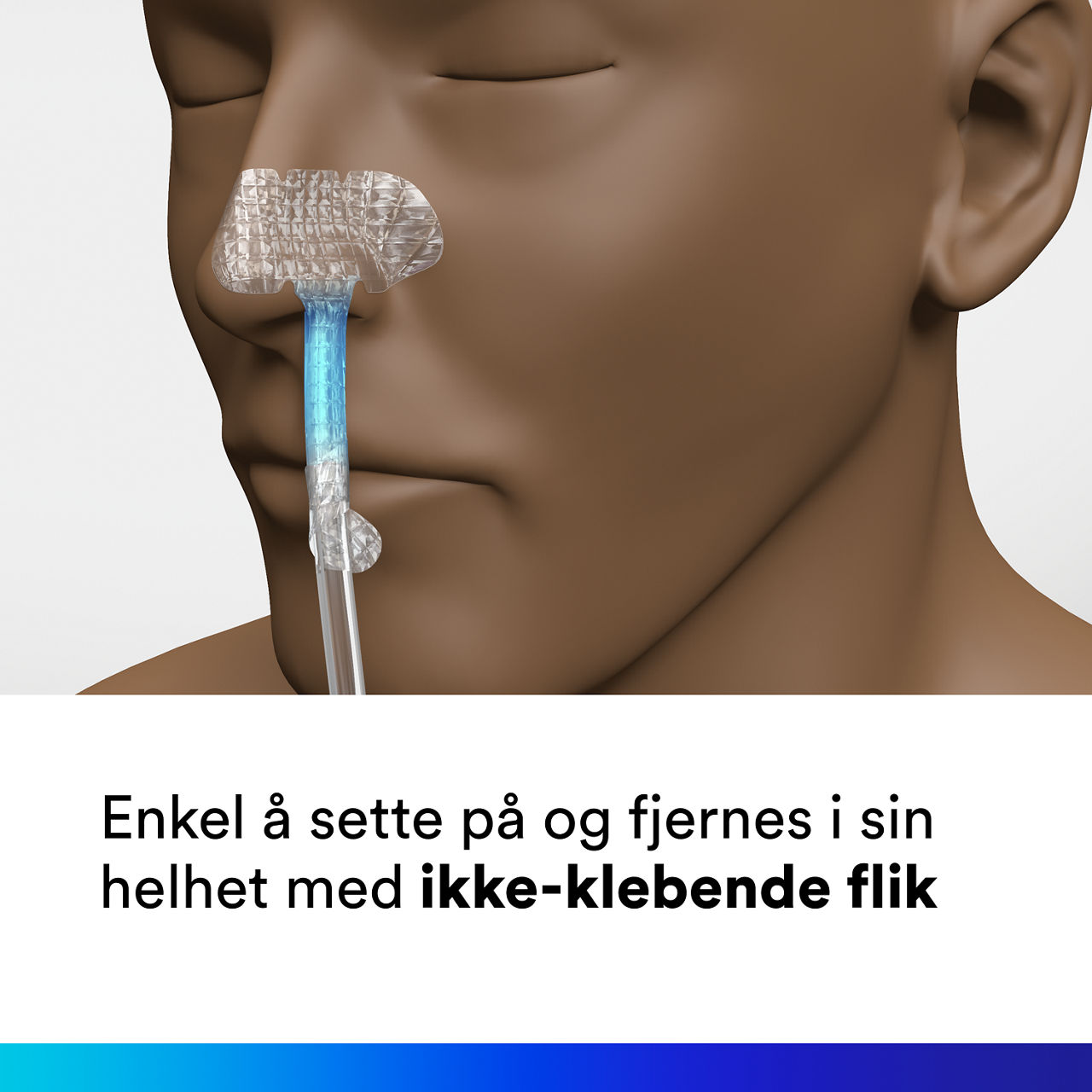(4) Nasogastrisk festeanordning: Lett å påføre og fjernes enkelt med en ikke-klebende flik