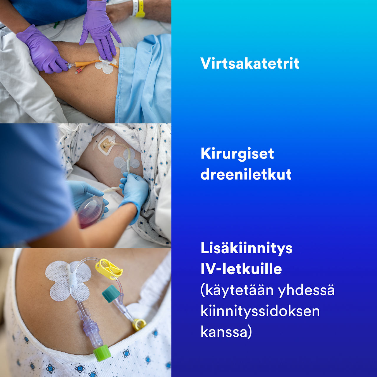 3 Putkien kiinnityslaite: Virtsakatetrit, kirurgiset tyhjennysputket