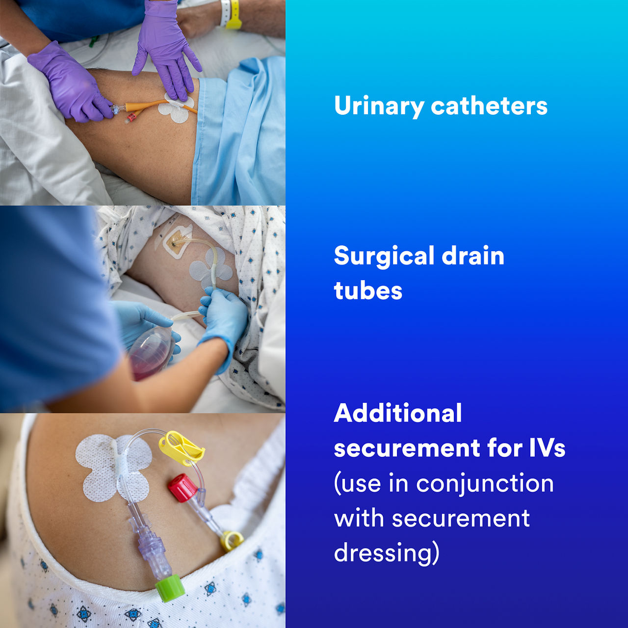 (3) Tube Securement Device: Urinary catheters, Surgical drain tubes, Additional securement for IVs