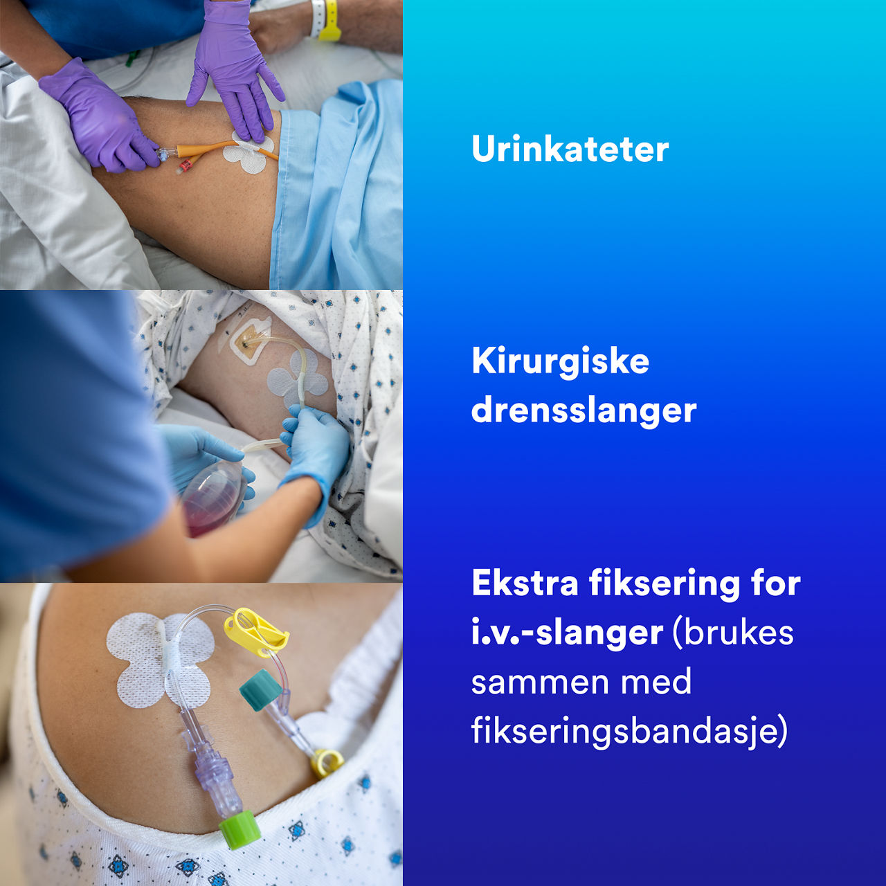 Tube Securement Device: Urinary catheters, Surgical drain tubes, Additional securement for IVs_NO