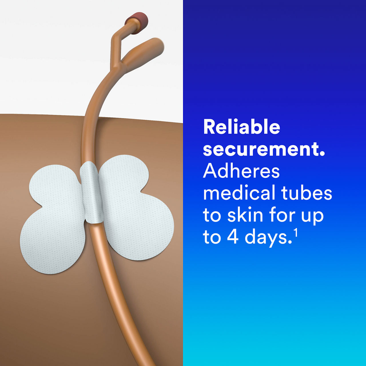 (4) Tube Securement Device: Reliable securement (en-ca)