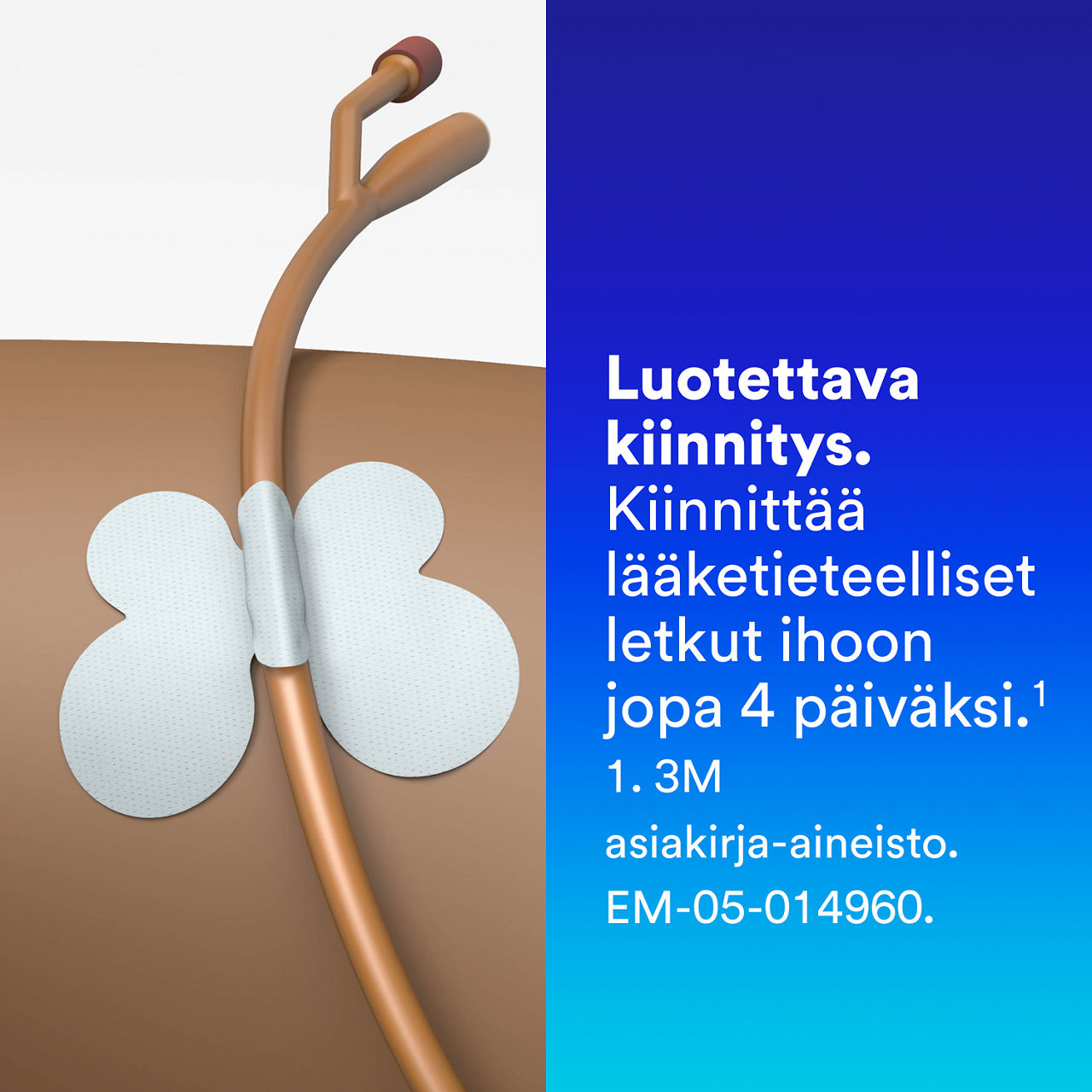 (4) Putkien kiinnityslaite: Luotettava kiinnitys