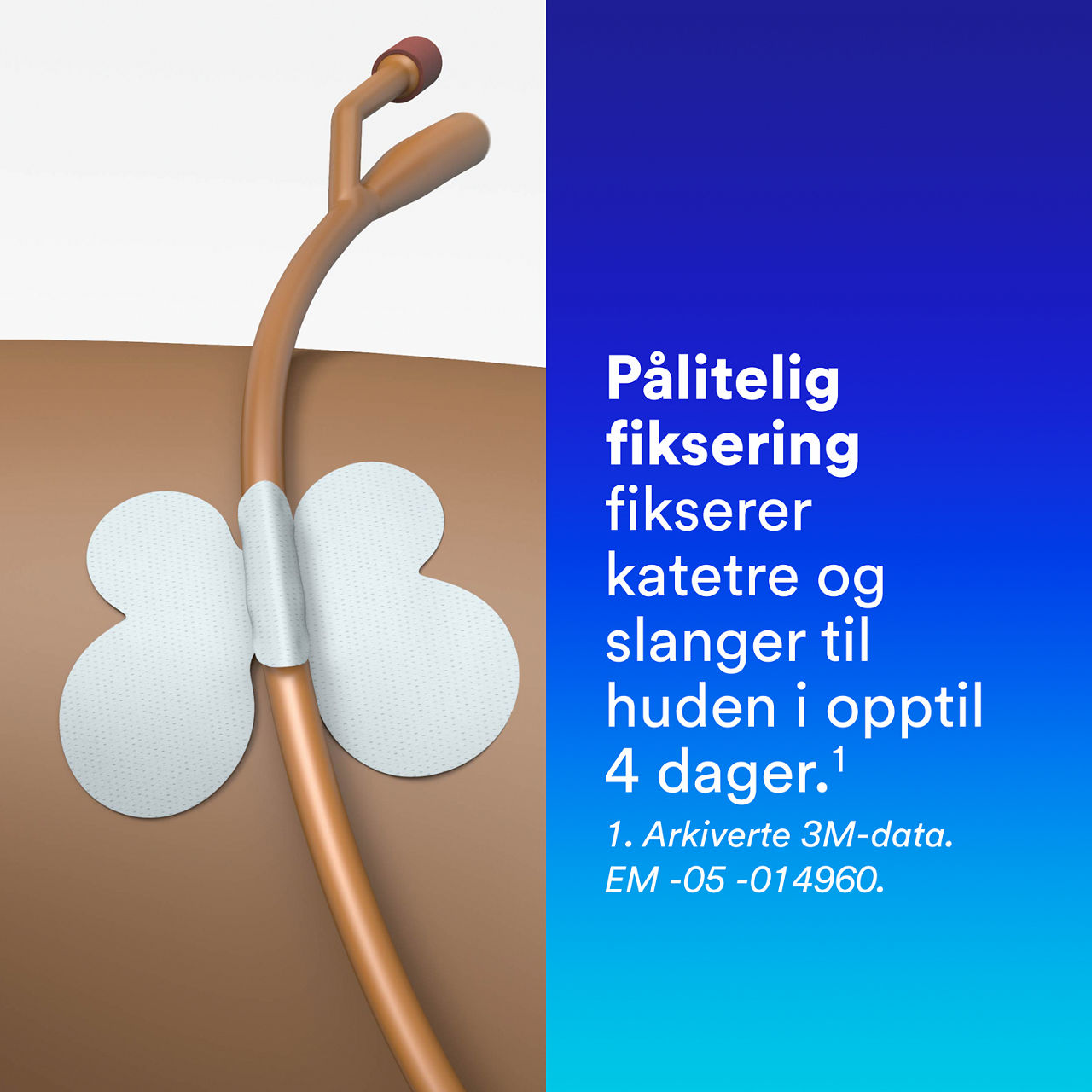 (4) Festeanordning for slanger: Pålitelig sikring