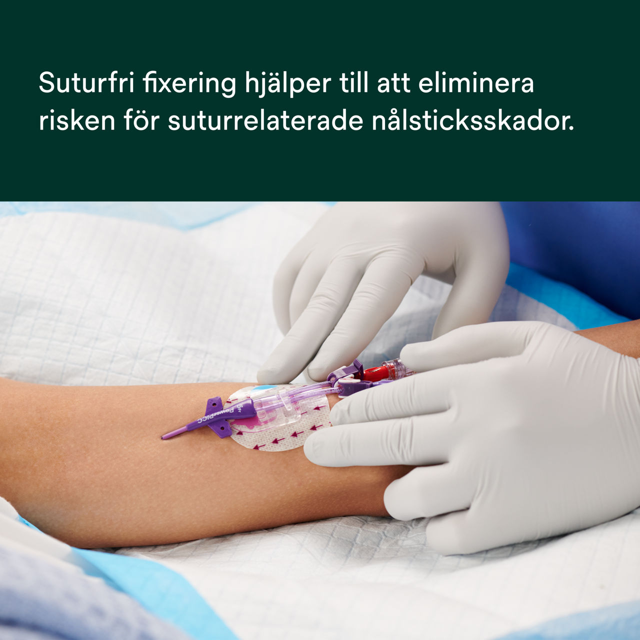 (2) PICC/CVC-anordning + CHG IV-förband: Komponenter till förband