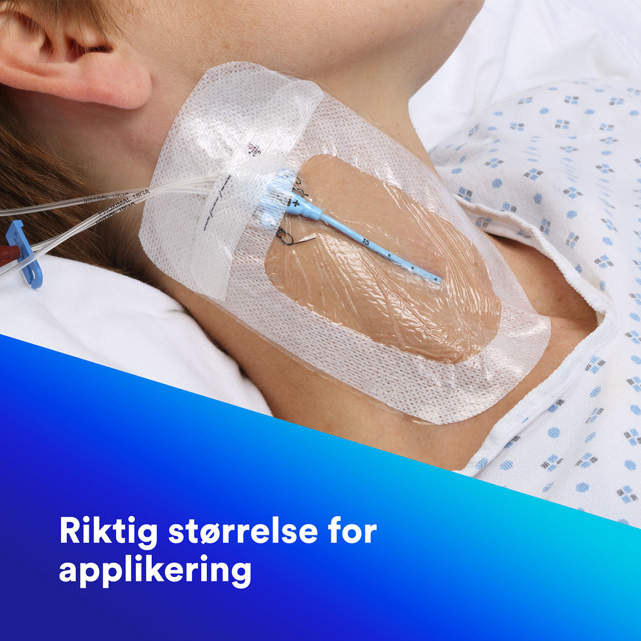 (2-1689) Tegaderm™ IV Advanced Securement: Sikker vedheft, synlighet på stedet, fuktighetshåndtering