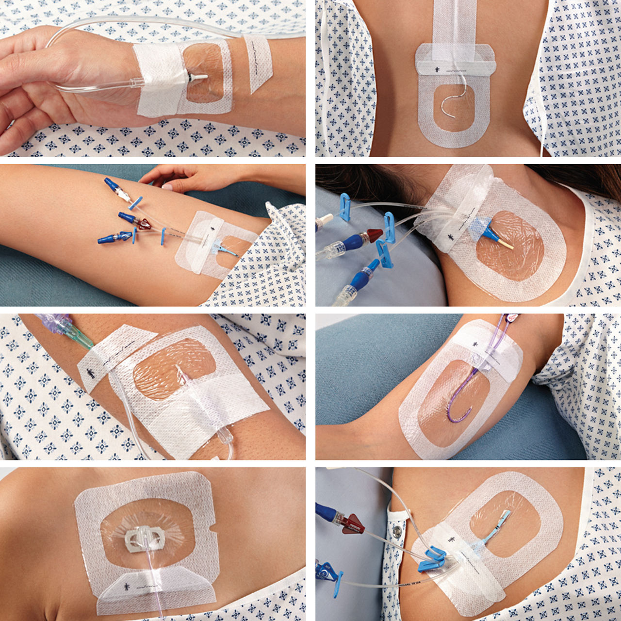 3M™ Tegaderm™ I.V. Advanced Securement Dressing | Solventum