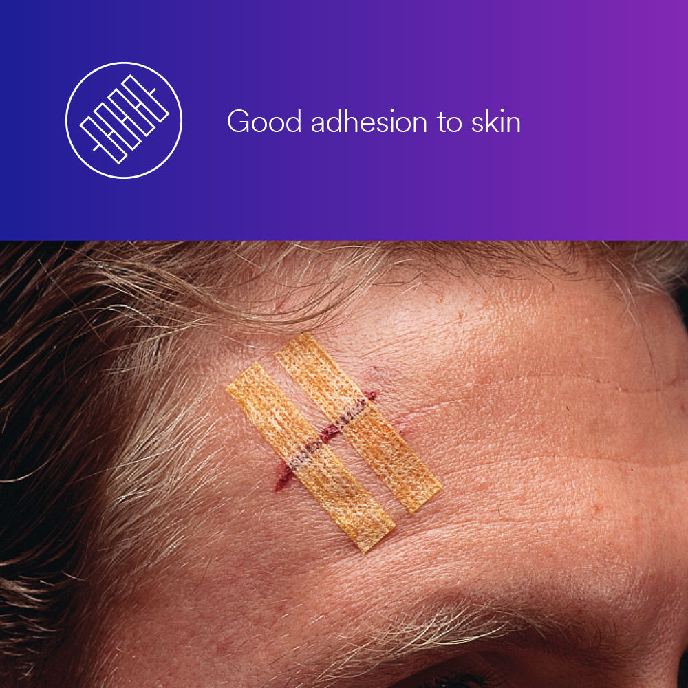 3M™ Steri-Strip™ Antimicrobial Skin Closure B+ Image 1