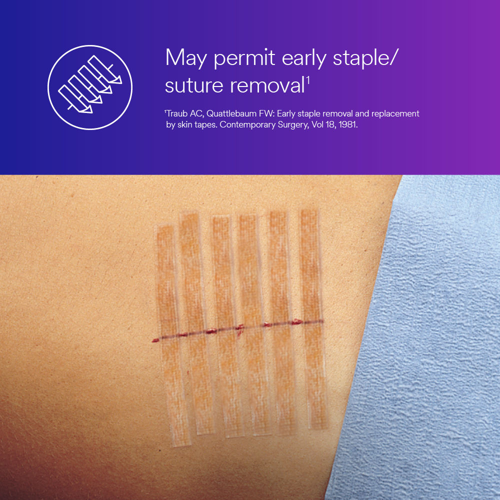 3M™ Steri-Strip™ Antimicrobial Skin Closure B+ Image 2