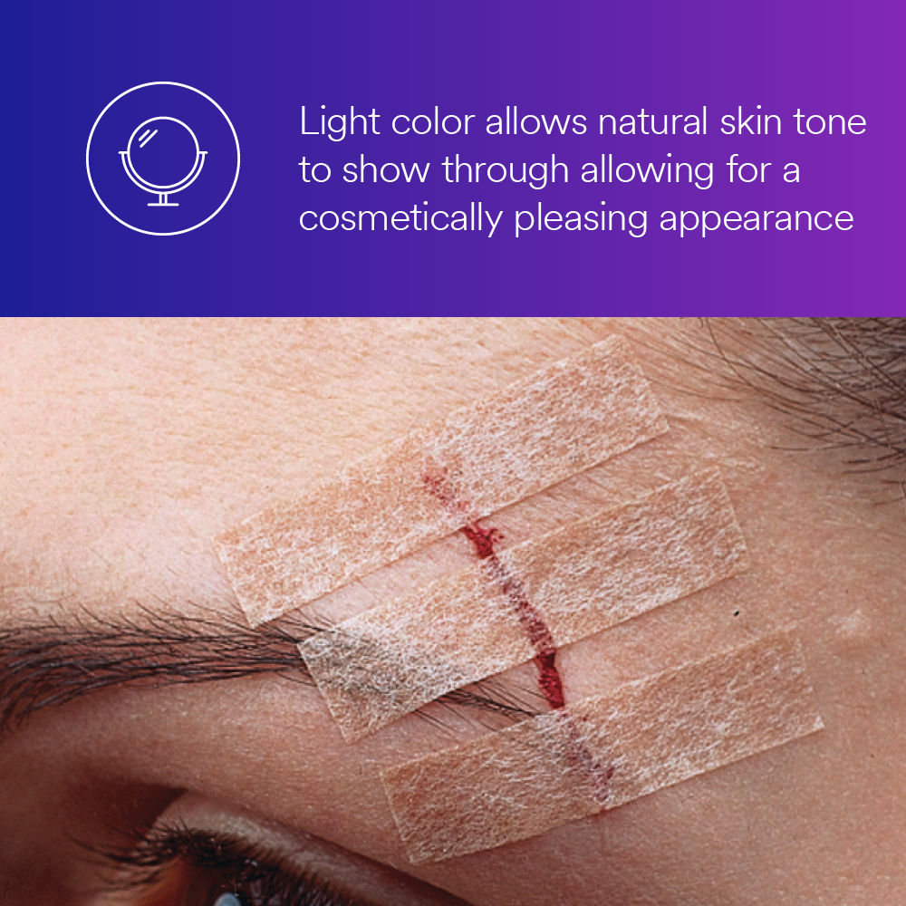 3M™ Steri-Strip™ Blend Tone Skin Closure B+ Image 1