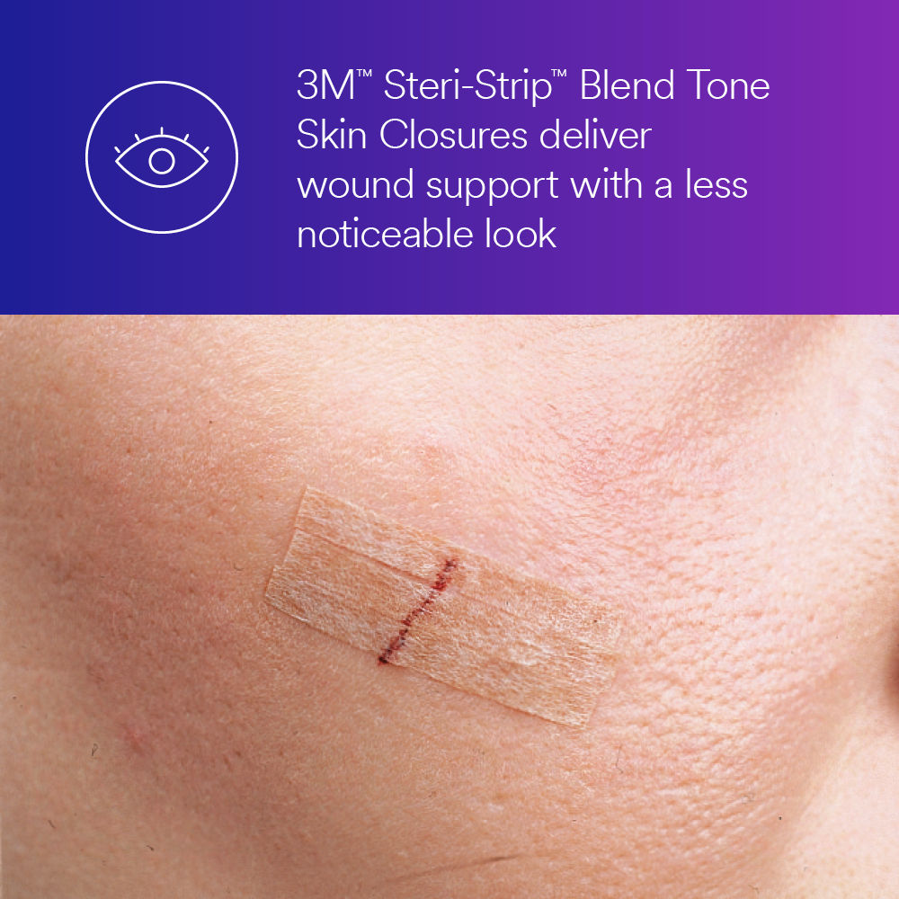 3M™ Steri-Strip™ Blend Tone Skin Closure B+ Image 2