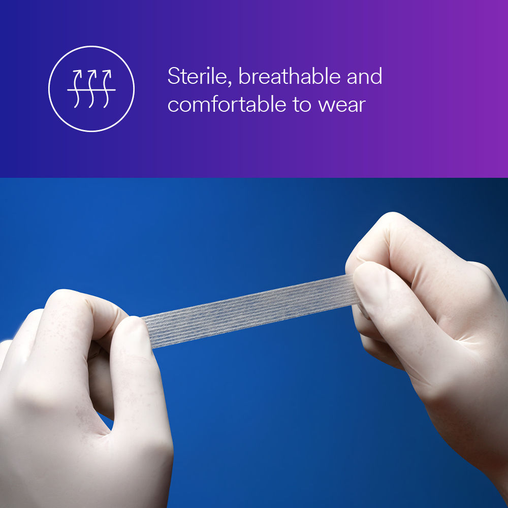 3M™ Steri-Strip™ Reinforced Skin Closure Image 1