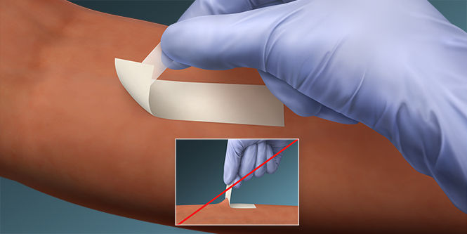 To remove, loosen the tape’s leading edge

