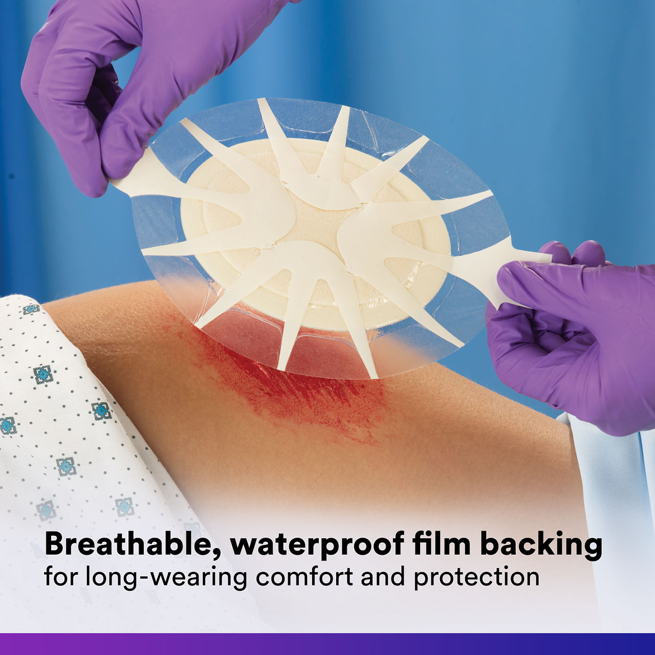 (4)Tegaderm HP Foam: Breathable waterproof film backing - 90613