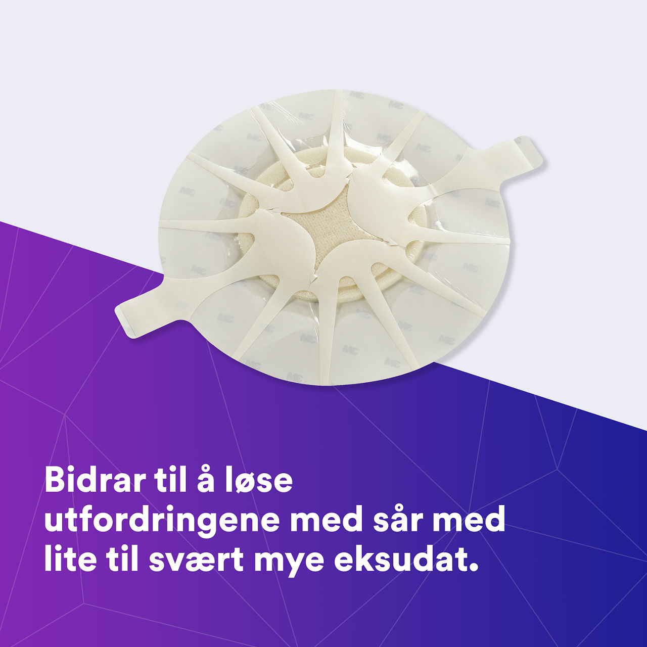 (1) Tegaderm HP Foam: Hjelper til å møte utfordringene ved lite til sterkt væskende sår - 90619