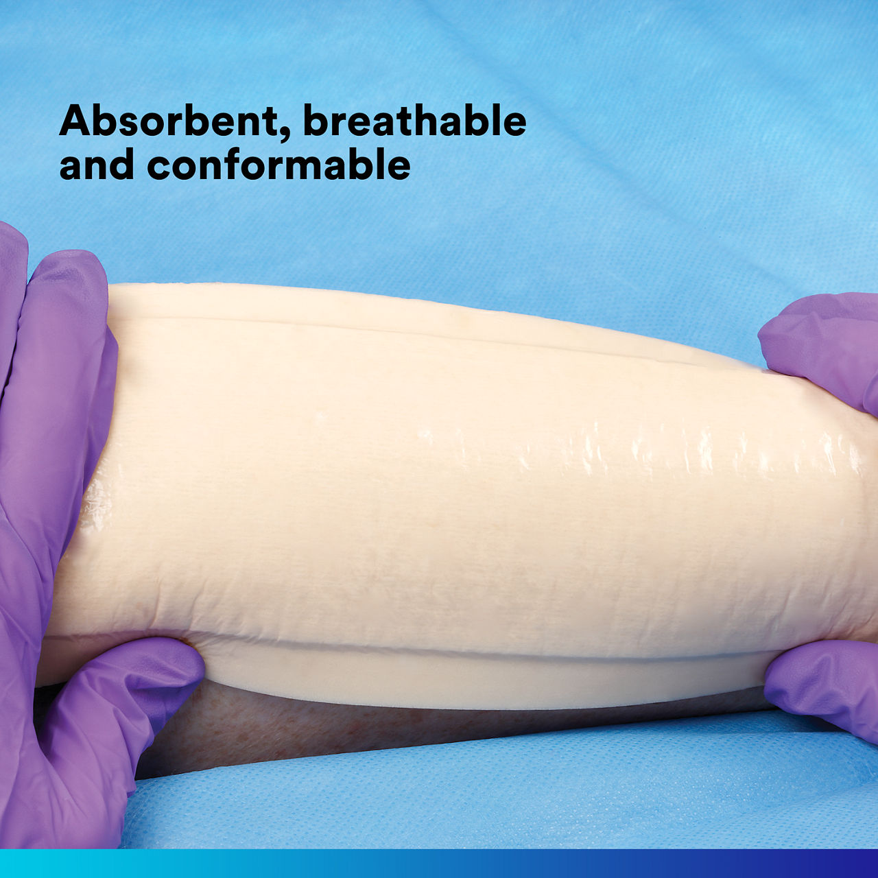 (3) Tegaderm HP Foam Non-Adhesive: Absorbent, breathable and conformable