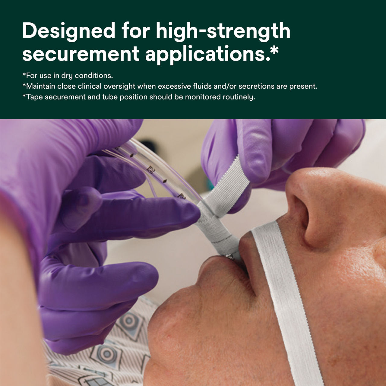 (2) Multipore Dry Surgical Tape: Designed for high strength securement applications