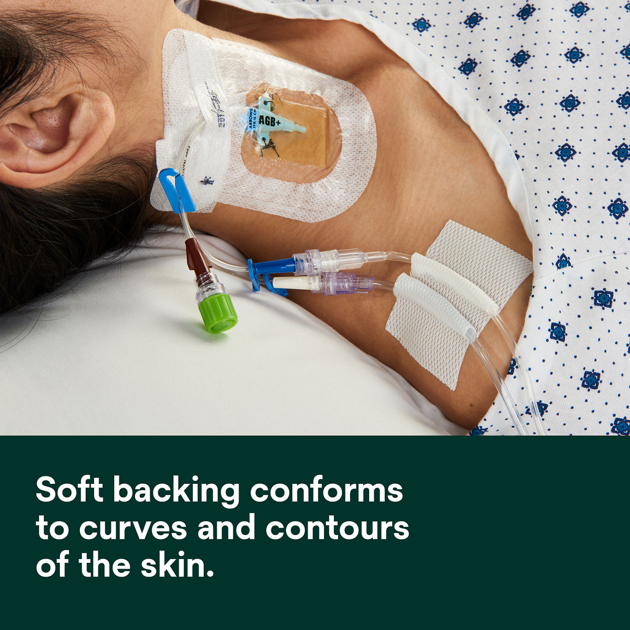 (4) Multipore Dry Surgical tape: Soft backing conforms to curves and contours of the skin