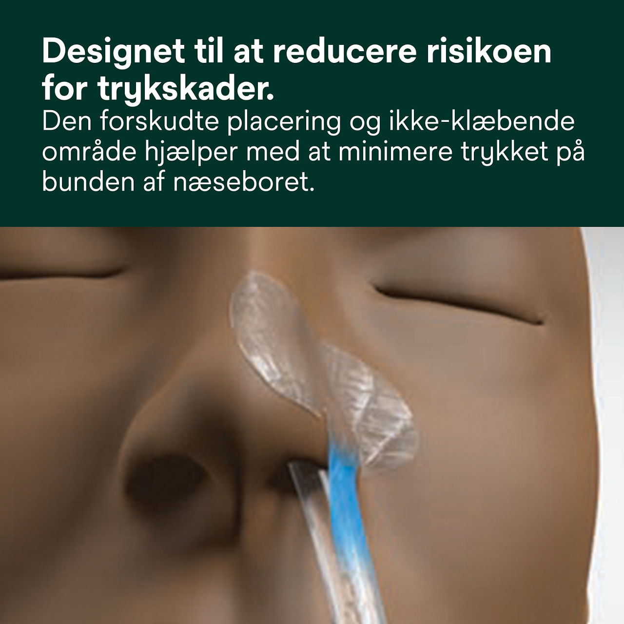 (1) Nasogastrisk sikkerhedsanordning: Designet til at hjælpe med at reducere risikoen for trykskader